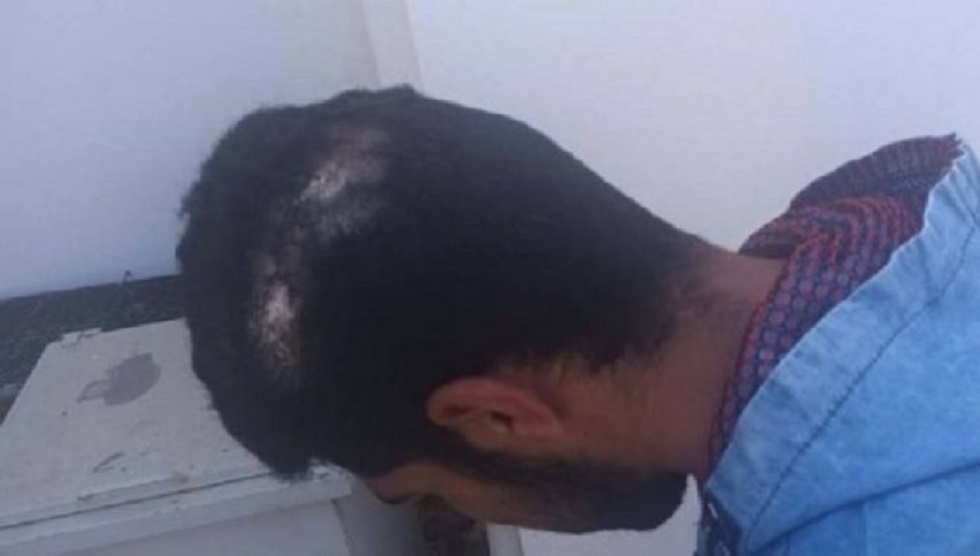 Χανιά: Τη Δευτέρα η δίκη του 47χρονου εργολάβου που κατηγορείται για ξυλοδαρμό 23χρονου εργάτη με αλυσίδα