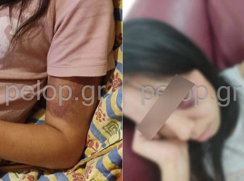 Σοκάρει υπόθεση κακοποίησης 16χρονης από τον σύντροφό της: Την απήγαγε και την ξυλοκόπησε δημόσια