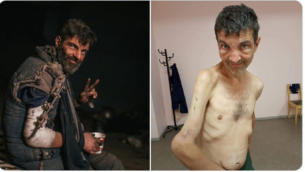 Ουκρανία: Η εικόνα «πριν» και «μετά» ενός Ουκρανού αιχμαλώτου αποτυπώνει τη φρίκη του πολέμου