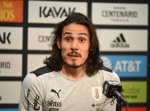 Καβάνι: «Έκλεισε η πόρτα του πορτμπαγκάζ πάνω στο νύχι μου, ήμουν έξι ώρες σε νάρκωση για την επέμβαση»