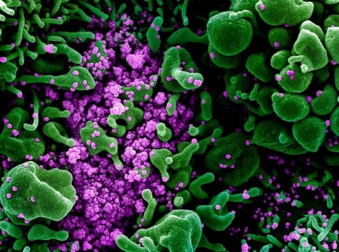 XBB.1.5: Πόσο καλύπτεται από εμβόλια και αντισώματα το νέο στέλεχος του κορωνοϊού