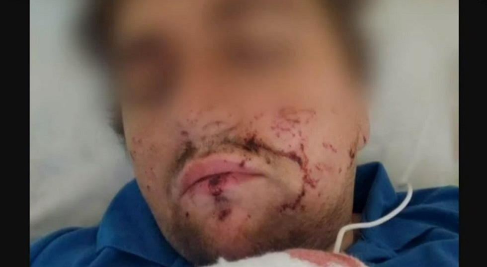 Σοβαρά τραυματισμένος Έλληνας στρατιώτης που πολεμά στο Μπαχμούτ της Ουκρανίας