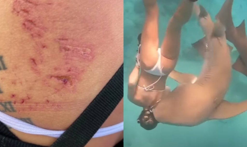 ΣΟΚ: Στιγμές τρόμου για κολυμβήτρια – Τη δάγκωσε καρχαρίας 100 κιλών