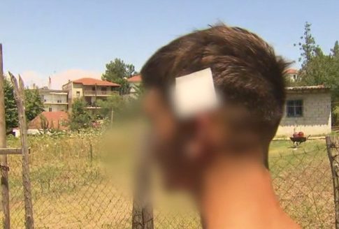 «Ένιωσα ένα κάψιμο και το κεφάλι μου γέμισε αίματα» – Συγκλονίζει ο 17χρονος που τον πυροβόλησε ηλικιωμένος
