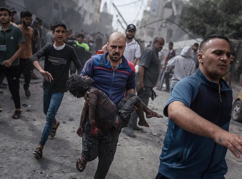 Λωρίδα της Γάζας: Οι γιατροί χειρουργούν χωρίς μορφίνη ή παυσίπονα