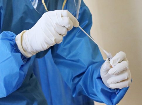 Σε έξαρση ο κορωνοϊός και οι αναπνευστικές λοιμώξεις – Έρχεται η κορύφωση