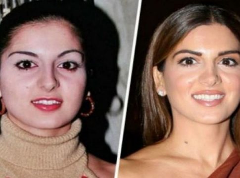 Πριν κόψει τη μύτη, αλλάξει δόντια & κάνει πλαστικές: Οι φωτογραφίες από το παρελθόν που η Σταματίνα Τσιμτσιλή θέλει να εξαφανίσει