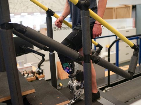 Βιονικό πόδι ελέγχεται για πρώτη φορά από το νευρικό σύστημα