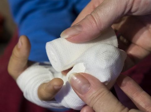 Προκαταρκτική εξέταση για τα εγκαύματα 4χρονου σε παιδικό σταθμό στο Βόλο