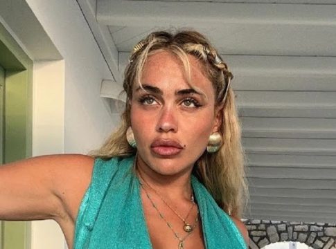 Τέλος τα φουσκωμένα χείλη για την Κόνι Μεταξά – Πιο όμορφη από ποτέ