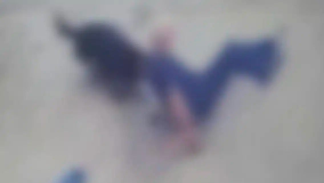 H στιγμή που Ροτβάιλερ κατασπαράζει τον ιδιοκτήτη του στην Καλαμάτα – Σκληρές εικόνες