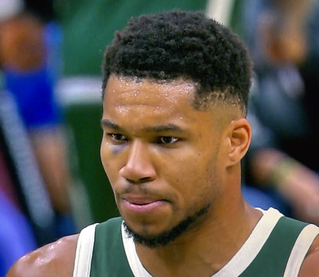 Ο Γιάννης Αντετοκούνμπο εξήγησε πώς μαύρισε το μάτι του (vid)