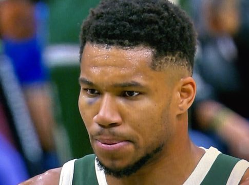 Ο Γιάννης Αντετοκούνμπο εξήγησε πώς μαύρισε το μάτι του (vid)