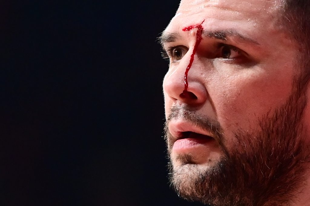 Μάτωσε στο πρόσωπο ο Παπανικολάου από αγκωνιά και αποχώρησε για τα αποδυτήρια