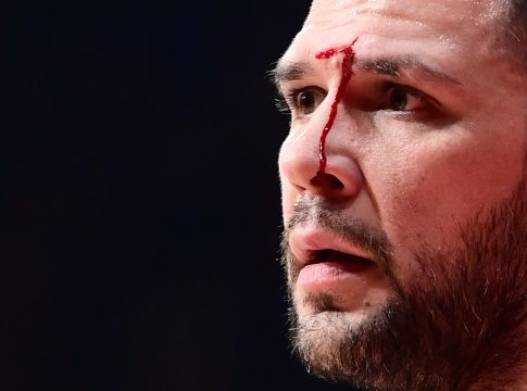 Μάτωσε στο πρόσωπο ο Παπανικολάου από αγκωνιά και αποχώρησε για τα αποδυτήρια