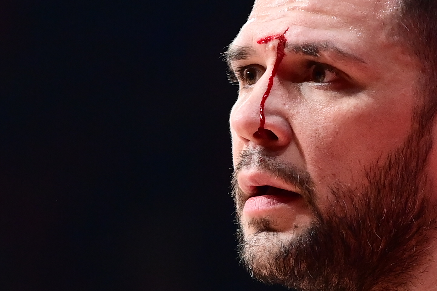 Μάτωσε στο πρόσωπο ο Παπανικολάου από αγκωνιά και πήγε στα αποδυτήρια