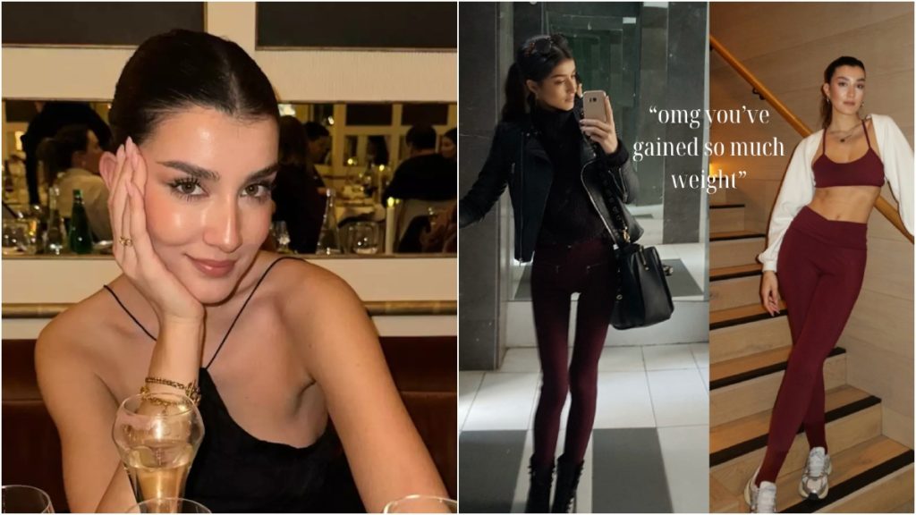 Κατερίνα Βισέρη: Η χρόνια μάχη με τη νευρική ανορεξία και το μήνυμα δύναμης