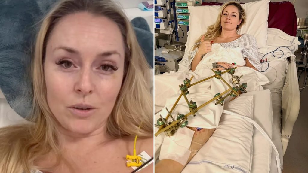 Η εντυπωσιακή επιχείρηση μεταφοράς της Λίντσεϊ Βον στις ΗΠΑ (vid)