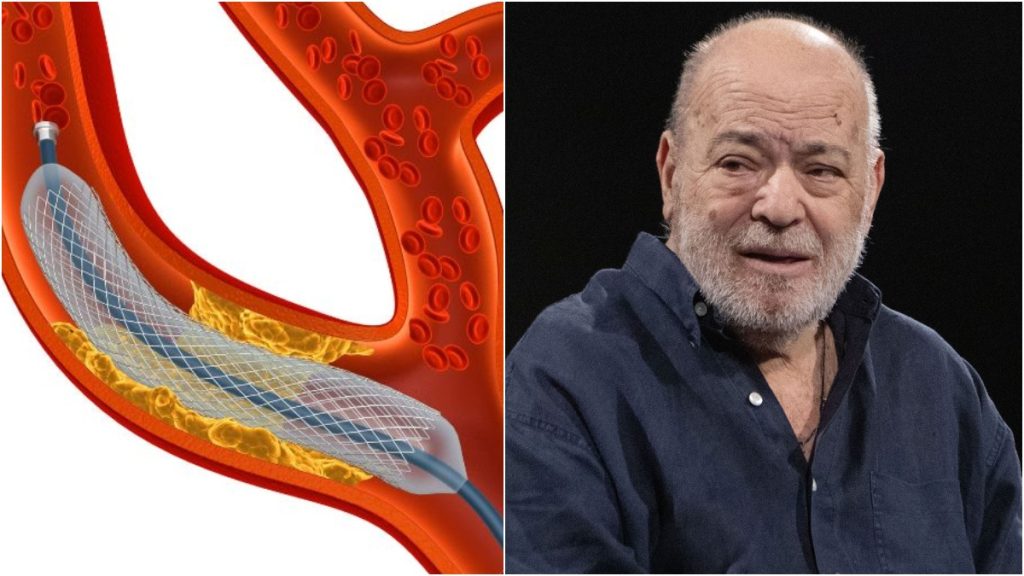 Χρήστος Βαλαβανίδης: Τι είναι η αθηρωμάτωση, το πρόβλημα στην καρδιά που είχε ο ηθοποιός και του στέρησε την ζωή