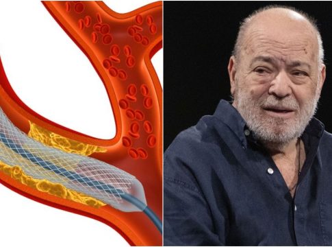 Χρήστος Βαλαβανίδης: Τι είναι η αθηρωμάτωση, το πρόβλημα στην καρδιά που είχε ο ηθοποιός και του στέρησε την ζωή