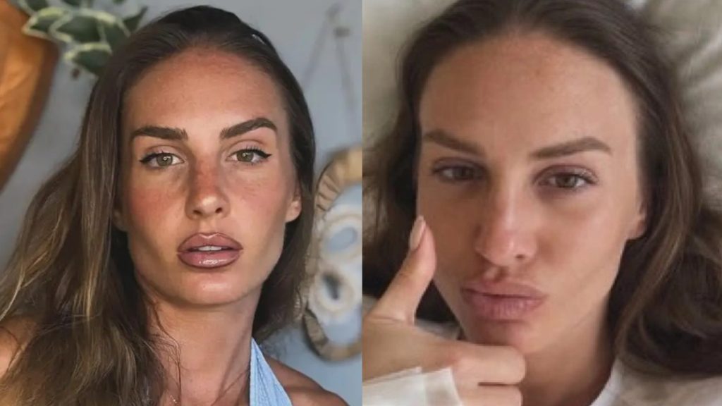 Δύσκολες στιγμές για την Κατερίνα Δαλάκα: Στο νοσοκομείο η αθλήτρια – Τι συνέβη