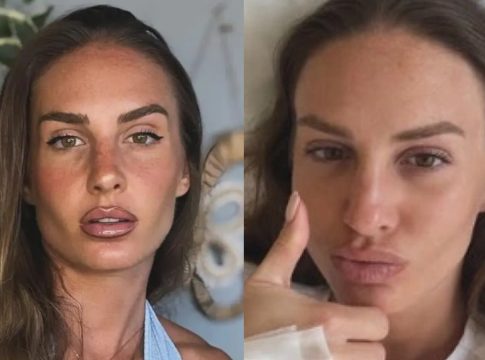 Δύσκολες στιγμές για την Κατερίνα Δαλάκα: Στο νοσοκομείο η αθλήτρια – Τι συνέβη