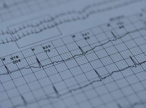 Σεισμός 6,7 Ρίχτερ στο Περού